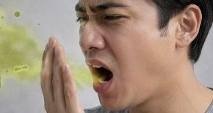Gigi Berlubang Bisa Bikin Napas Tak Sedap, Ini Penjelasannya